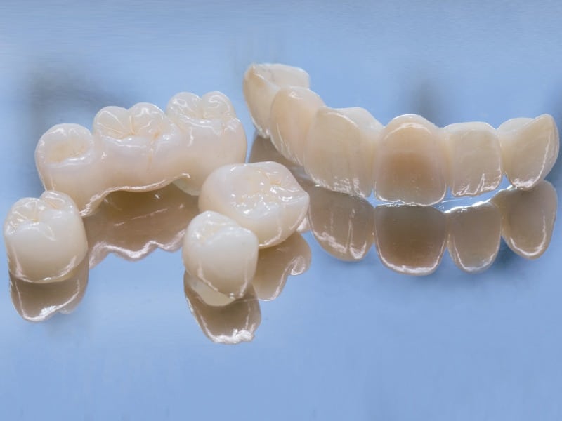 Metal Free Ceramic Dental Crowns. Ceramic zirconium