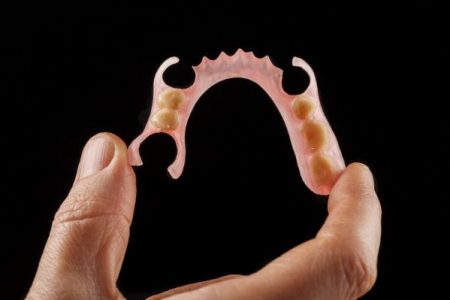 dental technician holding a flexible denture